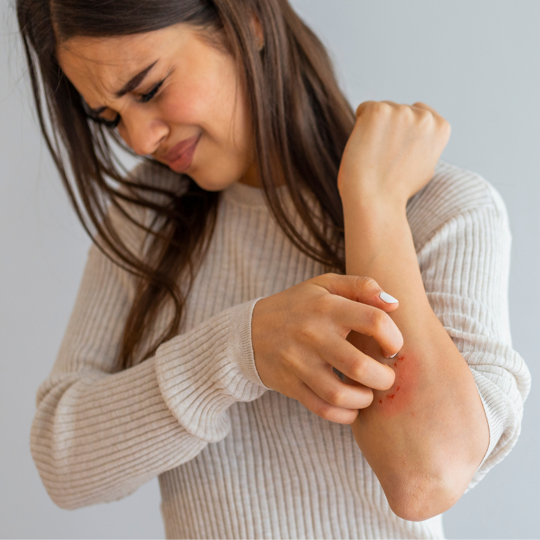 Understanding Eczema: Triggers and Solutions